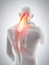 neck pain Royalty Free Stock Photo