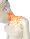 Neck painful - cervical spine skeleton x-ray, 3D illustration. Royalty Free Stock Photo