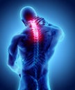 Neck painful - cervical spine skeleton x-ray, 3D illustration. Royalty Free Stock Photo