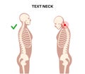 Neck vertebrae deformity