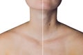 Neck of a woman before and after botox. Young and old neck Royalty Free Stock Photo