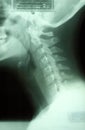 Neck x-ray Royalty Free Stock Photo