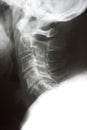 Neck xray