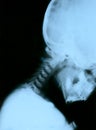 Neck xray Royalty Free Stock Photo
