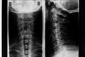 Neck xray Royalty Free Stock Photo