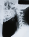 Neck Xray Royalty Free Stock Photo