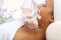 Needle Mesotherapy, face lift