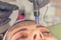 Needle mesotherapy treatment on a woman face.