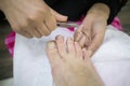 neglected feet and pedicure, foot care. feet in foamy water