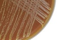 Neisseria bacterial colonies on chocolate agar plate