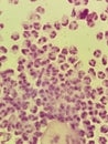 Neisseria gonorrhea - intracellular Gram negative diplococci