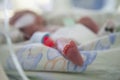 Neonatal Intensive Care Royalty Free Stock Photo