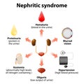 Nephritic syndrome Royalty Free Stock Photo