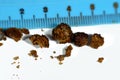 Nephrolithiasis, irregular brown kidney stones (renal calculus or nephrolith), the stones are different in size Royalty Free Stock Photo