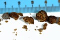 Nephrolithiasis, irregular brown kidney stones (renal calculus or nephrolith), the stones are different in size Royalty Free Stock Photo