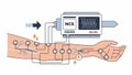Nerve Conduction Study (NCS) Royalty Free Stock Photo