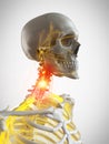 The nerves of the neck Royalty Free Stock Photo