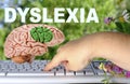 Neural Signature in human brain for Dyslexia, Disruption of Posterior Reading System, fingers on keyboard, concept of dyslexia Royalty Free Stock Photo