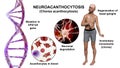 Neuroacanthocytosis, or Chorea acanthocytosis, a neurodegenerative disease, conceptual 3D illustration