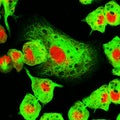 Neuroblastoma cell line under the microscope