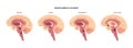 Neurochemical pathway diagram Royalty Free Stock Photo