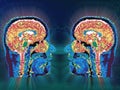 Neuroimaging or Brain Imaging