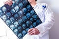 Neurologist or neurosurgeon upright holding MRI brain scanning viewing and exploring it for pathologies of central nervous system. Royalty Free Stock Photo