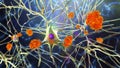 Neurons in Alzheimer's disease Royalty Free Stock Photo