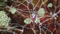 Neurons in Alzheimer's disease Royalty Free Stock Photo