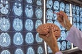A neurosurgeon holding brain model and pointing at brain MRI