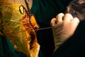 Neurosurgeon performing stereotactic biopsy in operating room Royalty Free Stock Photo