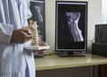 A neurosurgeon pointing at cervical spine model