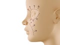 Neutral face profile with aesthetic surgery sign