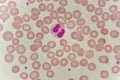 Neutrophil cell in blood smear