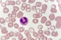 Neutrophil cell in blood smear