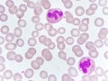 Neutrophil cell in blood smear