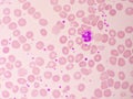 Neutrophil cell in blood smear