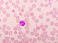 Neutrophil cell in blood smear