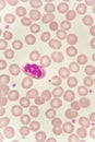 Neutrophil cell in blood smear