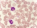 Neutrophil cell in blood smear