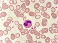 Neutrophil cell in blood smear