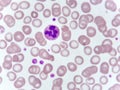 Neutrophil cell in blood smear