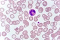 Neutrophil cell in blood smear