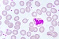 Neutrophil cell in blood smear