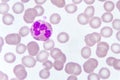 Neutrophil cell in blood smear