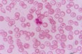 Neutrophil