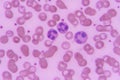 Neutrophil