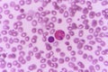 Neutrophil