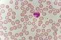 Neutrophil cell