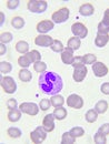 Neutrophil cell